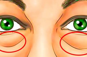 Этот продукт обладает суперсилой! За 15 минут исчезают мешки и темные круги под глазами. Без покупных кремов!