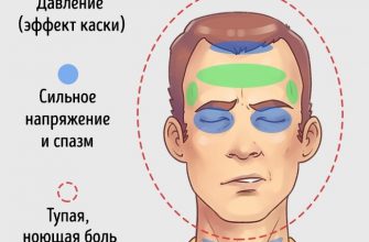 5 типов головной боли и способы быстро от них избавиться