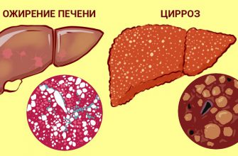 Эта хитрость защищает печень от разрушения! Нужно пить… Чтобы шлаки и токсины вышли.