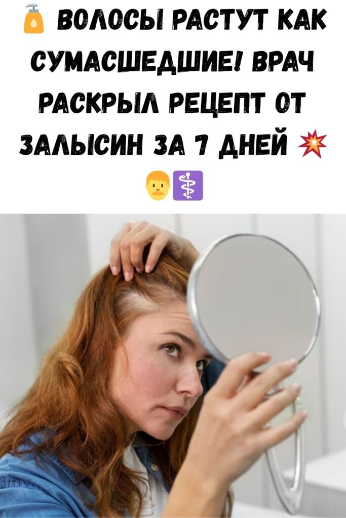 Залысины? Врач показал домашний способ, как сделать волосы густыми за 7 дней! Всего 4 ингредиента.