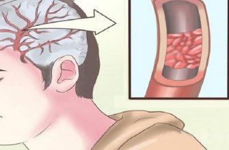 10 продуктов старательно очистят артерии: в целях профилактики инфаркта.