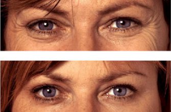 Быстрая и непринужденная подтяжка лица: когда смесь высохнет, станешь королевной