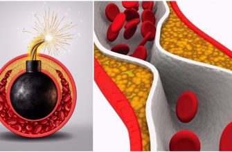 Тушари Джалаят: «Если тебе за 30, чистка сосудов — вопрос выживания!»