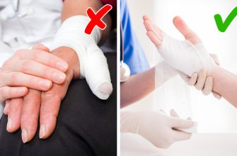 10+ простых приемов первой помощи, которые могут вас спасти