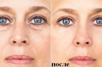 7 советов, которые избавят тебя от мешков под глазами. Взгляни на мир по-новому.