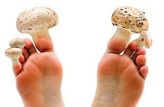 КАК ИЗБАВИТЬСЯ ОТ ГРИБКОВ И ПЛЕСЕНИ В ОРГАНИЗМЕ ЧЕЛОВЕКА?