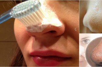 Как убрать черные точки на носу: индийский секрет поможет избавиться от гадкой проблемы!