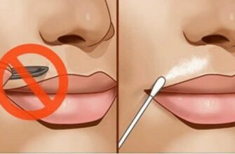 ПОПРОЩАЙТЕСЬ НАВСЕГДА С ВОЛОСАМИ НА ЛИЦЕ. С ЭТИМ ПРОСТЫМ РЕЦЕПТОМ…