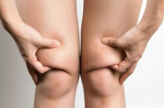 ОТКУДА БЕРУТСЯ ВАЛИКИ НАД КОЛЕНЯМИ, И ЧТО С НИМИ ДЕЛАТЬ?