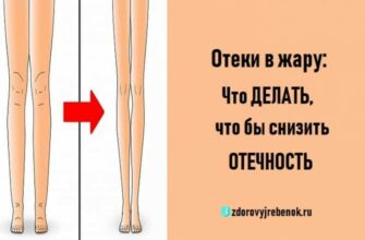 Отеки в жару: Что ДЕЛАТЬ, что бы снизить ОТЕЧНОСТЬ