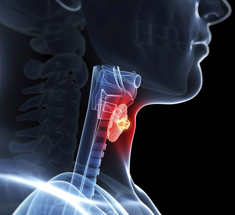 Симптомы ГИПОтиреоза и ГИПЕРтиреоза - Женский Журнал