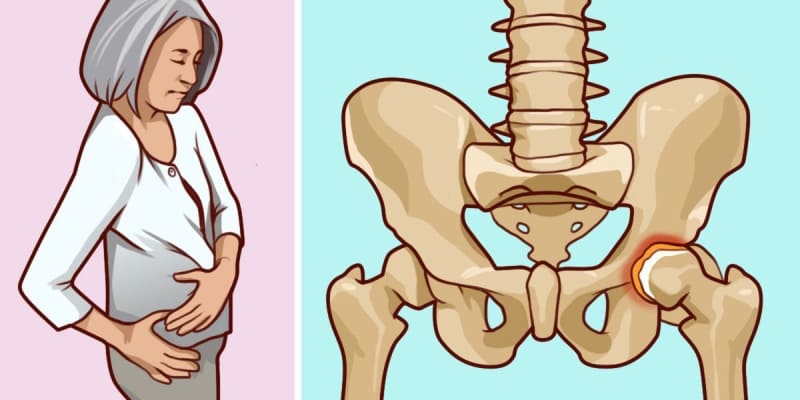 Восстановление хрящей суставов народными средствами